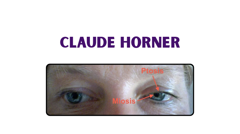 claude horner